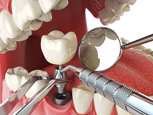 Best Emergency Dentist for Special Needs Patients in Stanford, CA